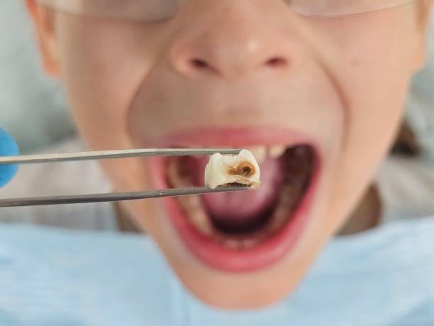 Best Emergency Gum Treatment in Coppell, TX